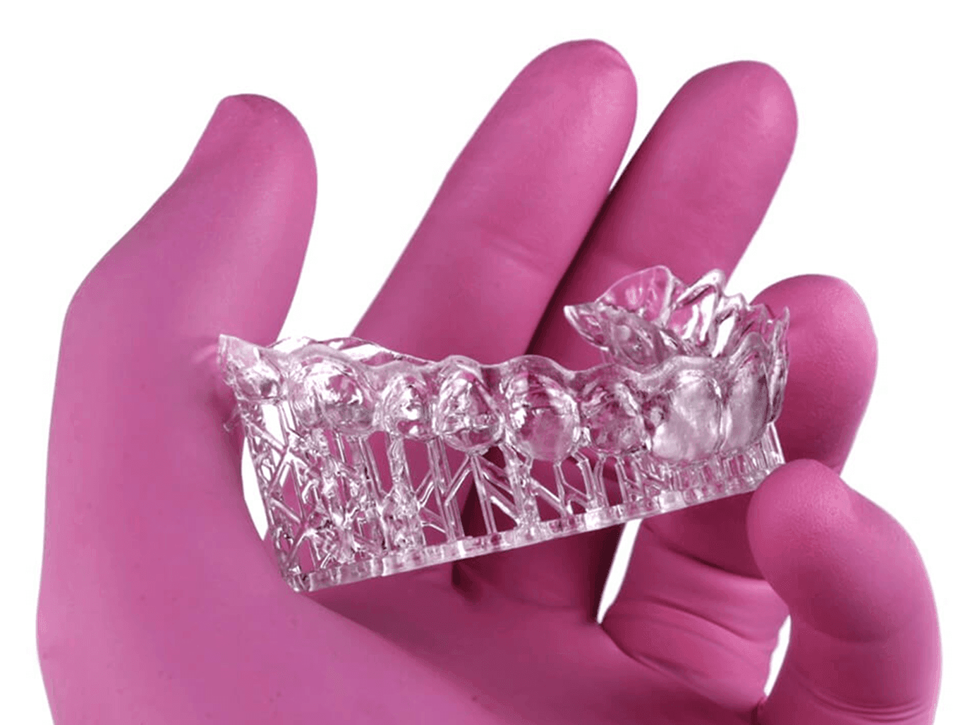 3D printing dental restorations workflow