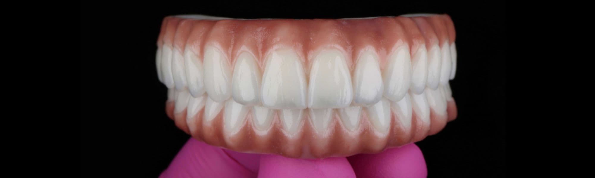 MOD Restorative Studio dental design services